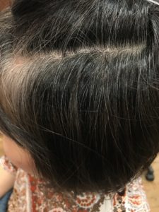 ノンジアミンカラー実例 市販のトリートメントカラー で髪が真っ黒になった くせ毛を生かしたヘアスタイル 縮毛矯正 髪質改善に特化したさいたま市南浦和 浦和にある美容院